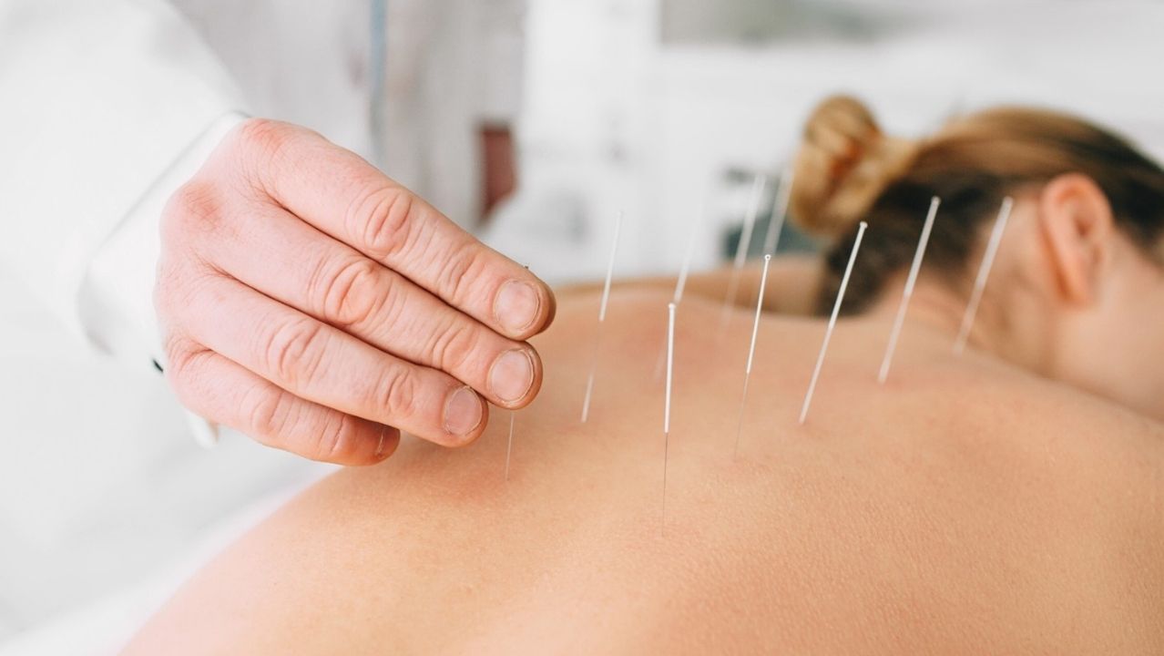 Acupuntura Alicante - Tratamientos | KLINIK PM Acupuntura Alicante - Tratamientos | KLINIK PM