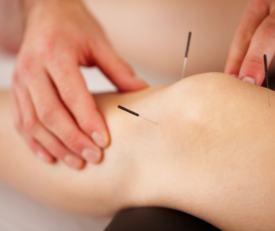 Alicante Acupuncture | KLINIK PM