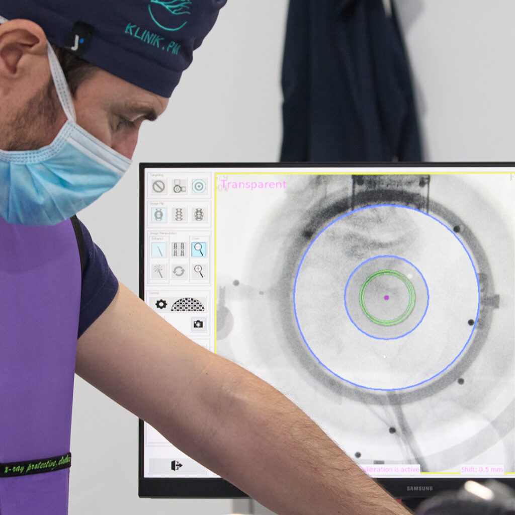 Tratamiento de la Artritis y Artrosis Facetaria Alicante | KLINIK PM